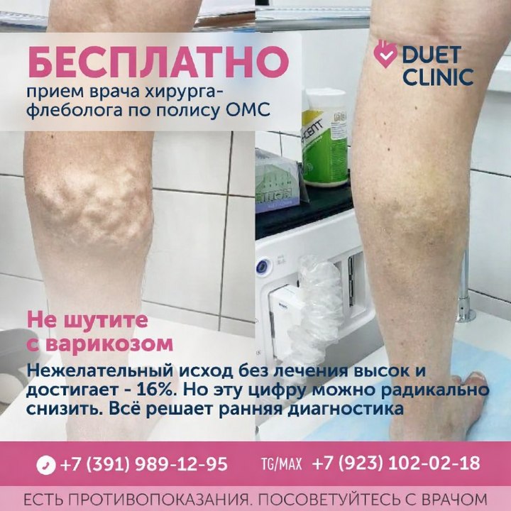 Бесплатный приём флеболога-хирурга + УЗИ вен ног по ОМС в Ачинске